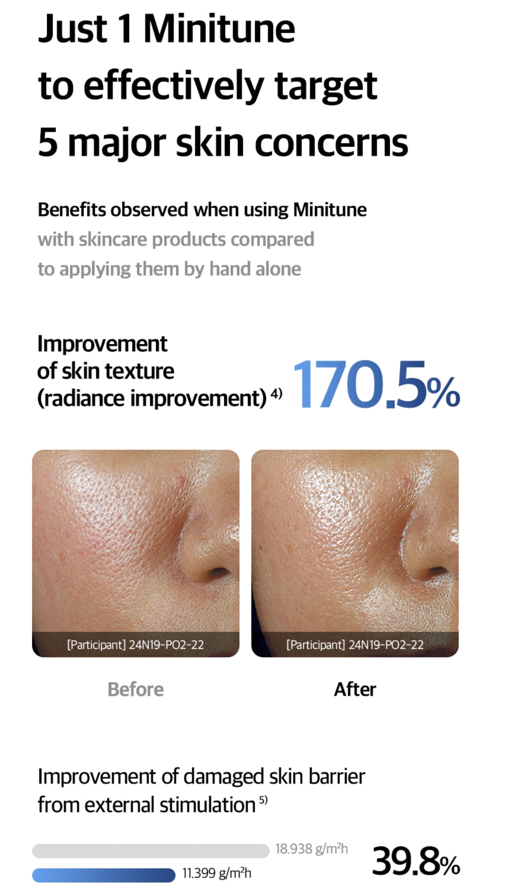 Quadthera Minitune 韓國 體積細小 效果強大 水滴美容儀 !!